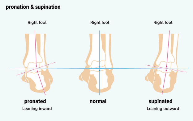 Supination in feet and exercises to correct it