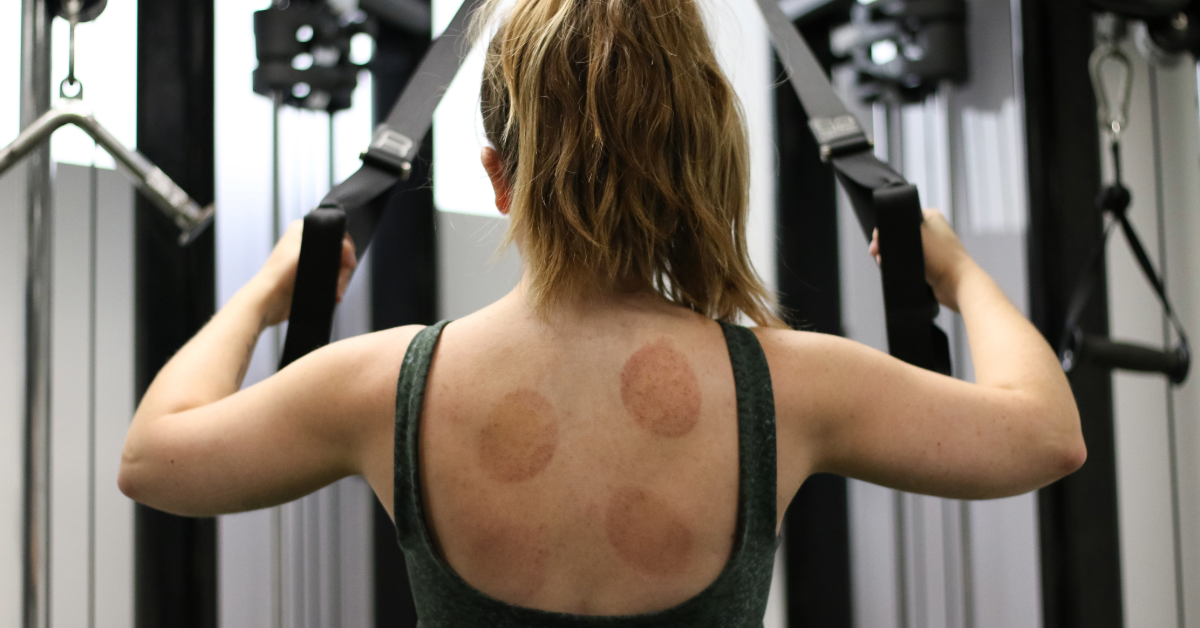 What Your Cupping Colors Are Telling You